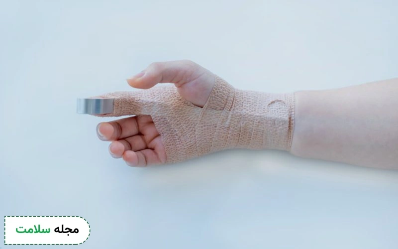 نحوه جا انداختن در رفتگی انگشت دست چگونه است؟