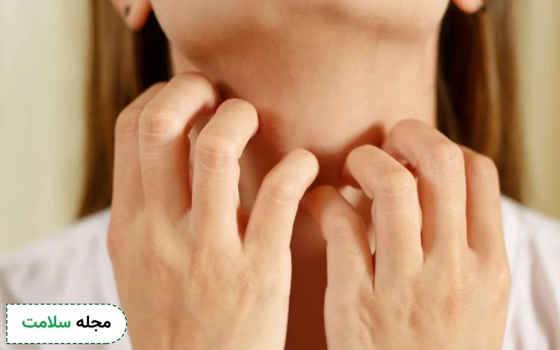 درمان خانگی خارش بدن ناشی از حساسیت چگونه است؟