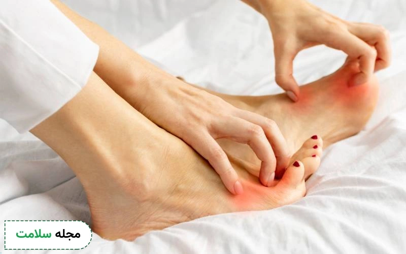 چگونه مانع خارش بدن در شب شویم؟
