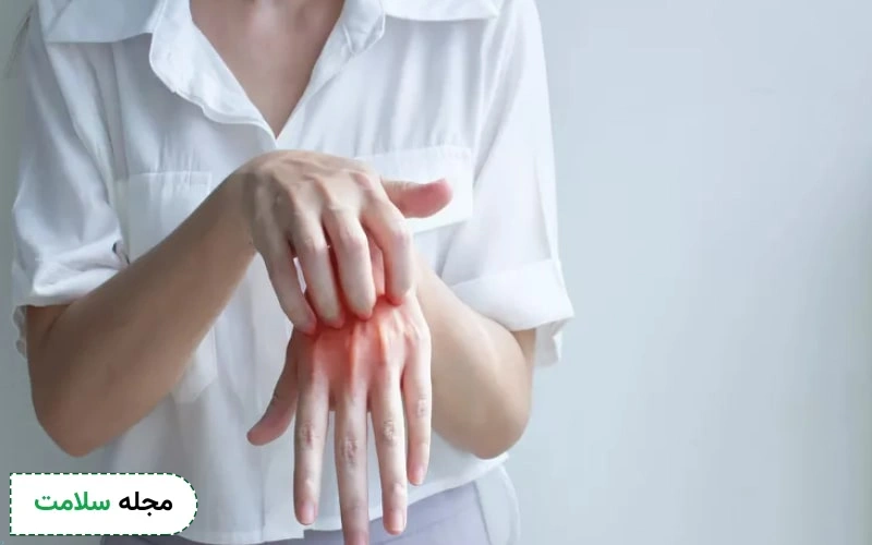 بررسی تصاویر انواع قارچ پوستی و نحوه شناسایی آنها