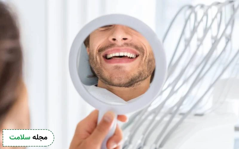بعد از کامپوزیت دندان چه چیزهایی نباید بخوریم؟