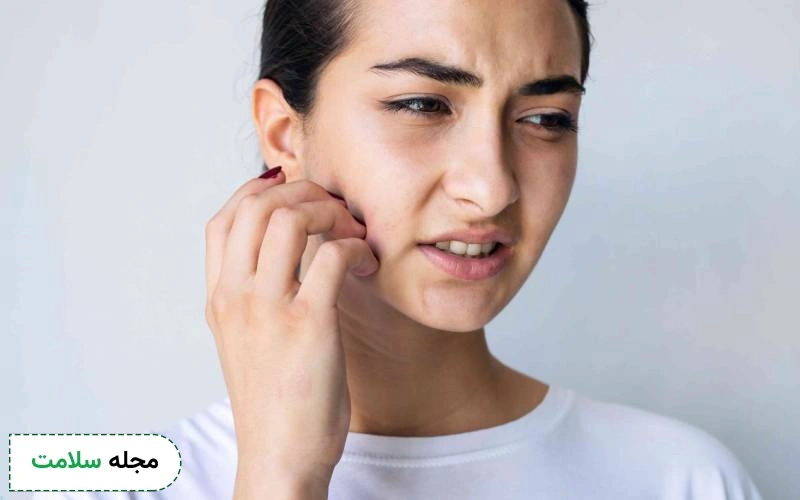 کمبود کدام ویتامین باعث خارش سر و بدن می شود؟