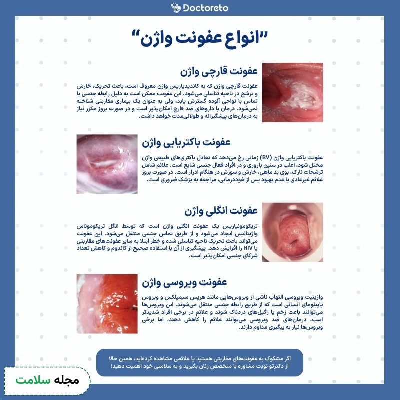 عکس انواع عفونت واژن در زنان