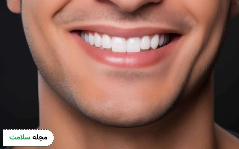 مراقبت پس از کامپوزیت دندان خرگوشی
