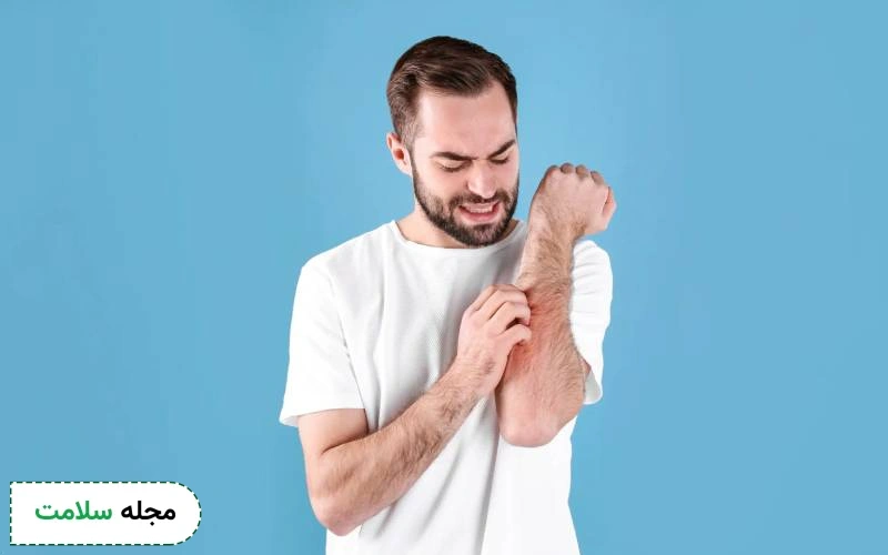 کمبود کدام ویتامین باعث خارش بدن میشود؟