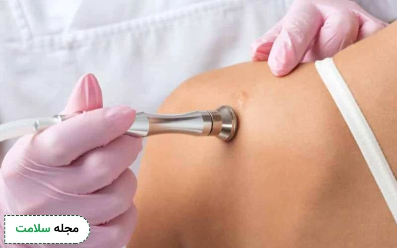 آیا اسکارهای کلوئید با دارو درمان می شود؟ 