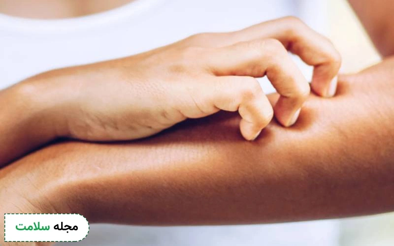 چه زمانی خارش بدن خطرناک است؟