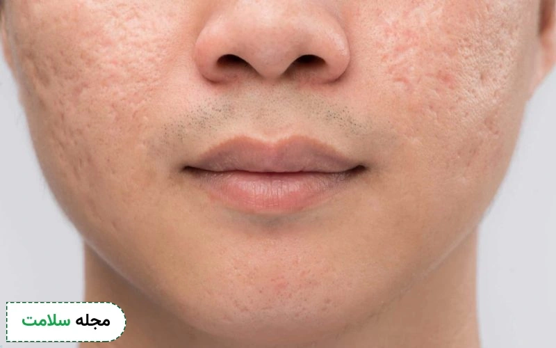 اسکار پوست چه ظاهری دارد؟