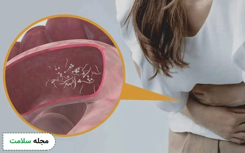 انگل روده چه علائم و عوارضی دارد؟ بهترین راه درمان آن چیست؟
