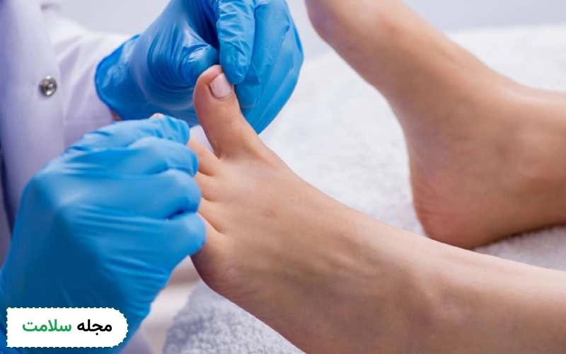 زخم پای دیابتی چیست و چرا ایجاد می شود؟