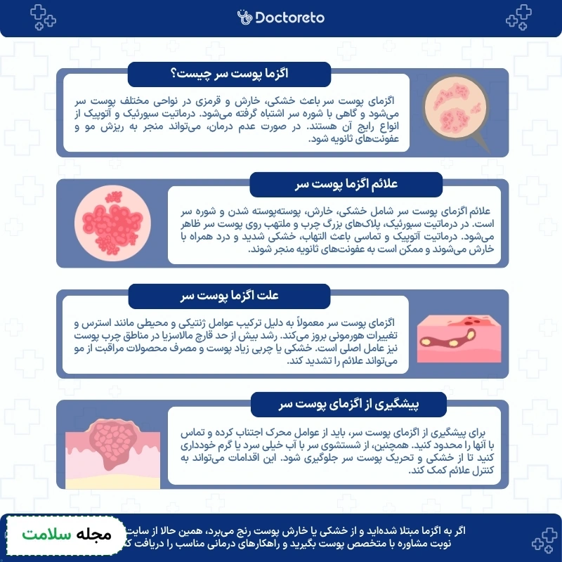 اینفوگرافی اگزمای پوست سر