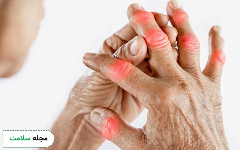 روماتیسم دست چه علائمی دارد؟ آیا میتوان آن را درمان کرد؟