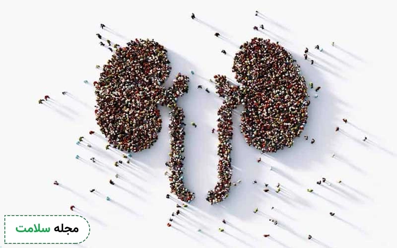 سنگ کلیه مردان چیست؟