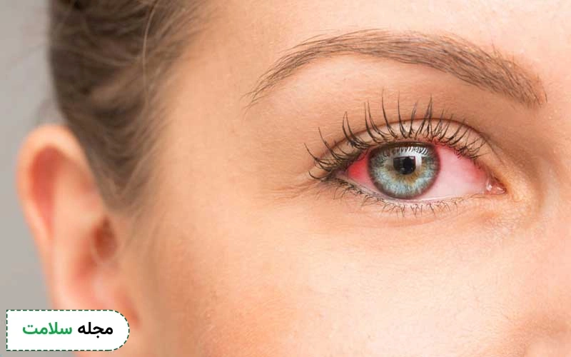 عفونت چشم چیست؟