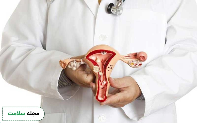 آمادگی برای لاپاراسکوپی رحم چگونه انجام می شود؟