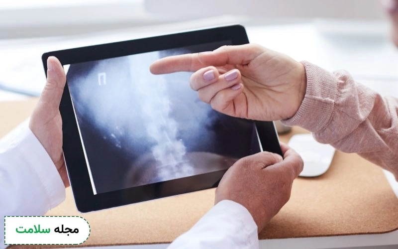 پاره شدن دیسک گردن تا چه اندازه خطرناک است؟