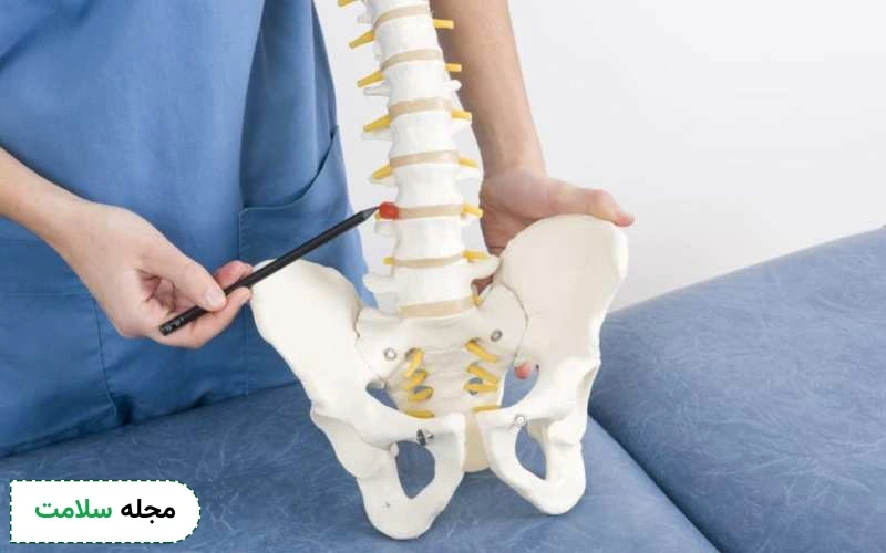 عکس فتق دیسک کمر چگونه است؟