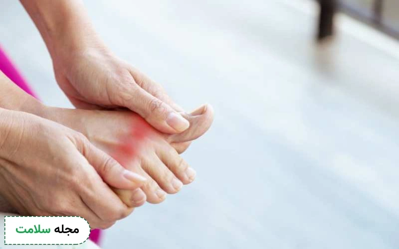 علائم نقرس کاذب چیست؟