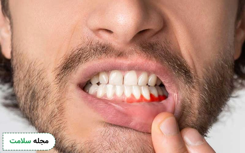 عفونت دندان چیست؟