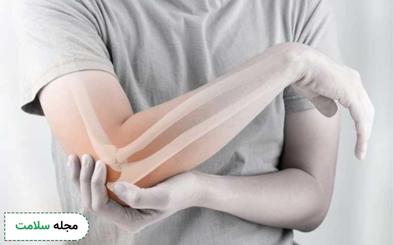 تاندونیت چه علائمی دارد؟ آیا قابل درمان است؟