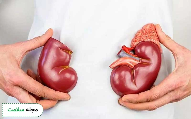 شن ریزه در کلیه چرا ایجاد میشود؟