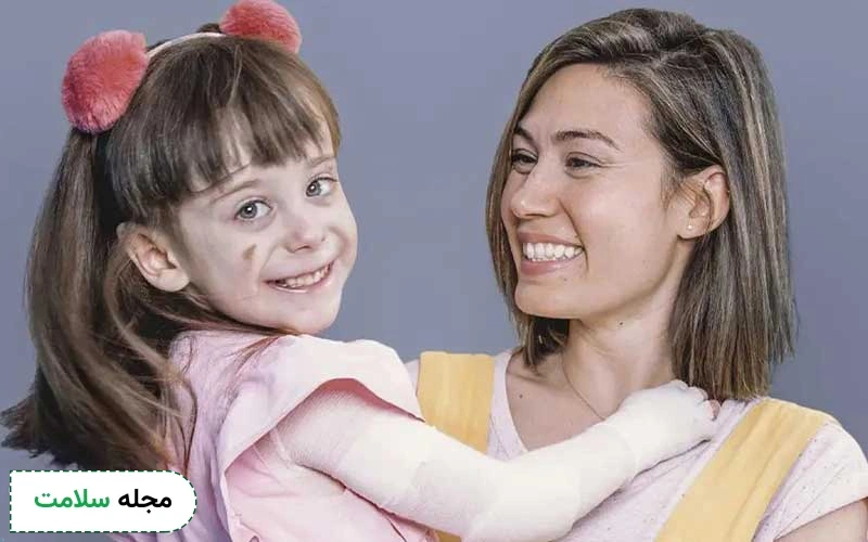 جلوگیری از ساییدگی زخم های پوستی بیماران پروانه ای
