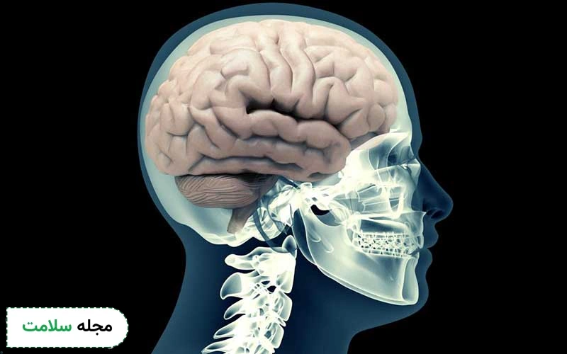 خونریزی مغزی چیست؟ آیا خونریزی مغزی باعث مرگ یا به کما رفتن میشود؟