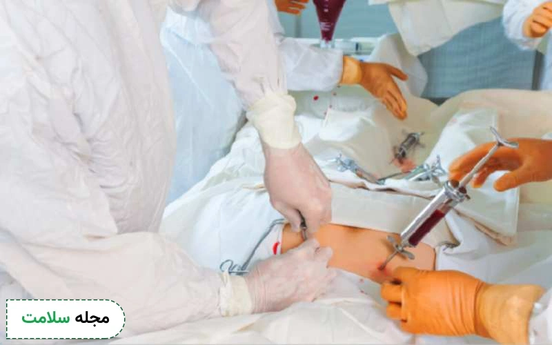 آیا می توان عوارض جراحی سرطان پانکراس را کاهش داد؟