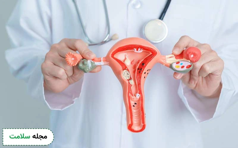 فیبروم در بارداری چگونه است و چه درمانی دارد؟