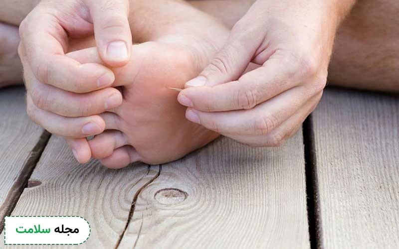 میخ آلوده ممکن است باعث ابتلا به بیماری کزاز شود.