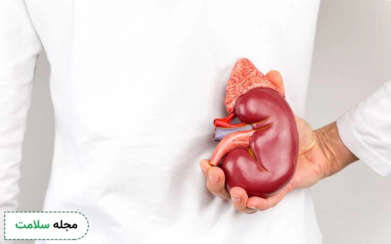 عمل سنگ کلیه چیست؟