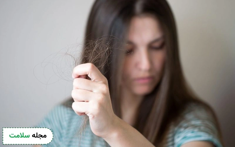 وسواس کندن مو چیست؟
