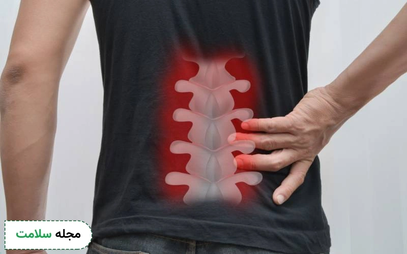 سندروم دم اسبی چند نوع است؟