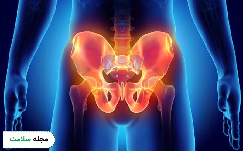 علت افیوژن مفصلی لگن چیست؟