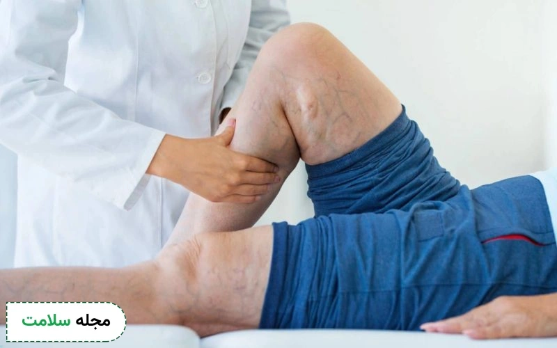 علائم فلبیت شامل درد و قرمزی در ناحیه سیاهرگ است.