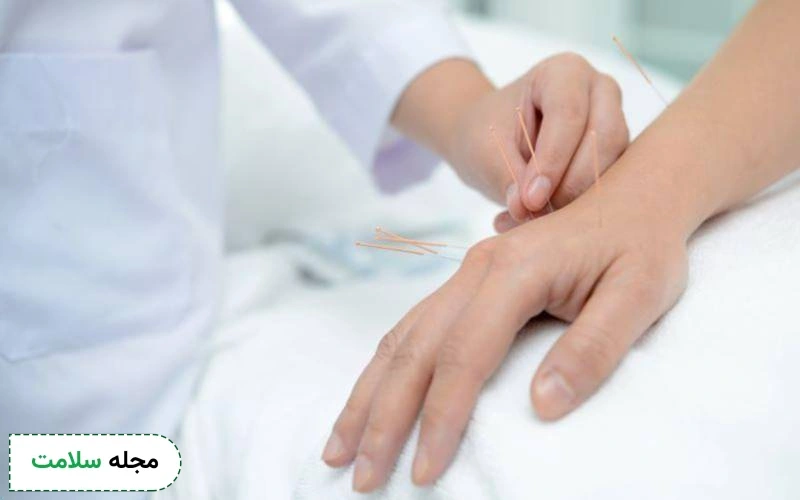 کاربرد طب سوزنی در درمان پارکینسون اثبات شده است.