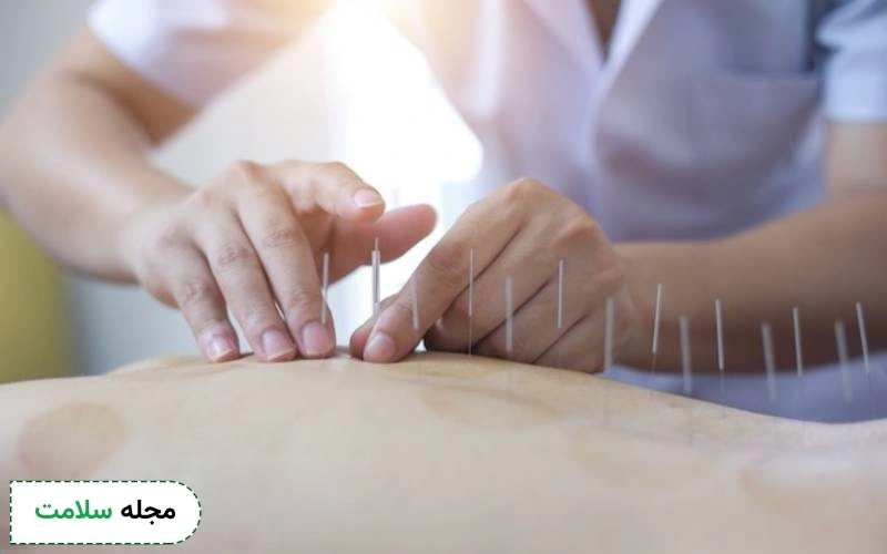 چه افرادی نمی توانند از طب سوزنی استفاده کنند؟