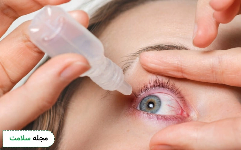 استفاده بهموقع از قطره های چشمی بعد لیزیک