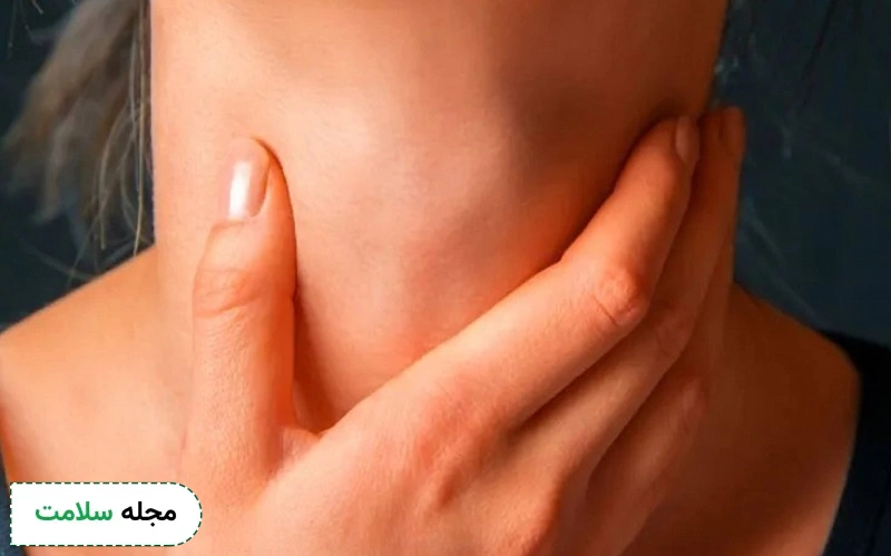 برای درمان خانگی گواتر چه بخوریم؟