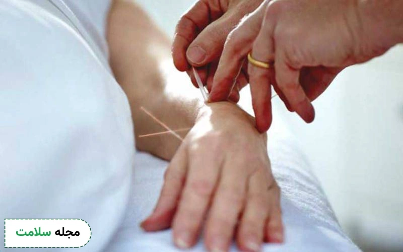 آیا درمان پارکینسون با طب سوزنی امکان پذیر است؟ مزایا و عوارض آن چیست؟
