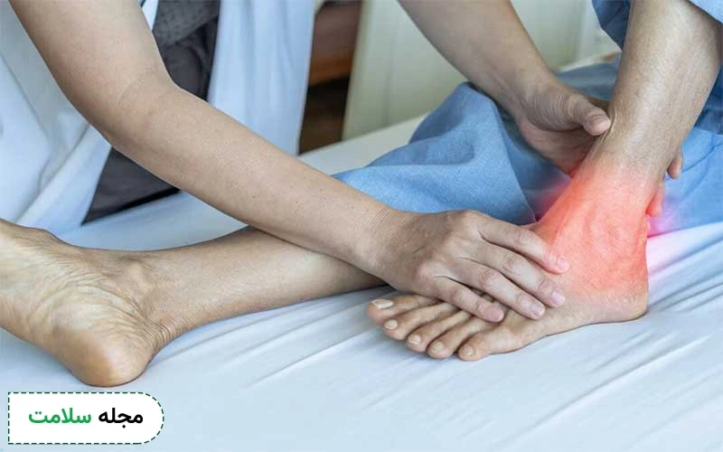 داروهای زیادی برای درمان نقرس وجود دارد.
