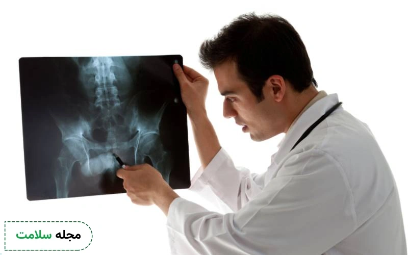 شکستگی دنبالچه چگونه است؟ علائم، راه های تشخیص و درمان این شکستگی