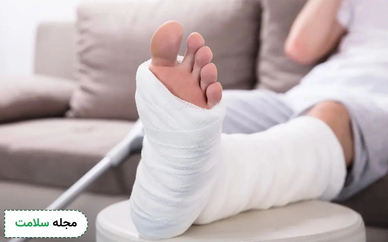 شکستگی پا چگونه است؟ علائم، راه های تشخیص و درمان این شکستگی