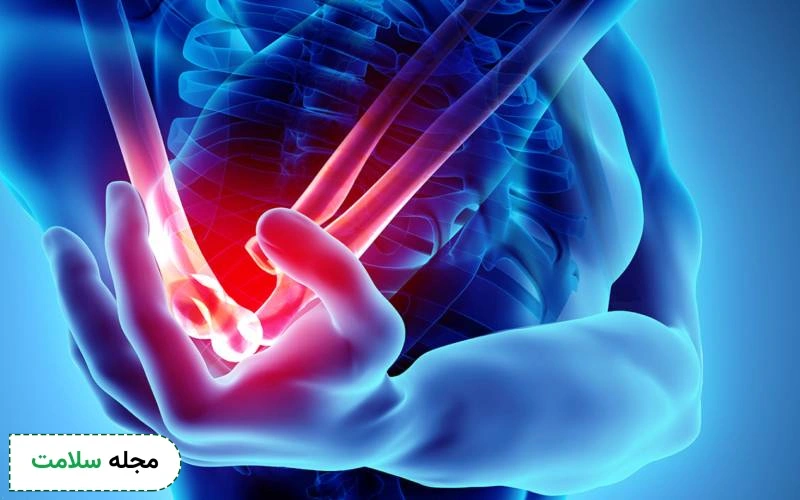 سندروم تونل کوبیتال چیست؟ علائم، علت و راه های درمان آن