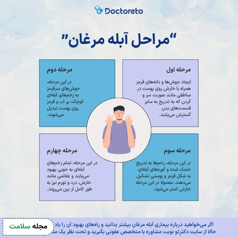 اینفوگرافی مدت زمان خوب شدن آبله مرغان