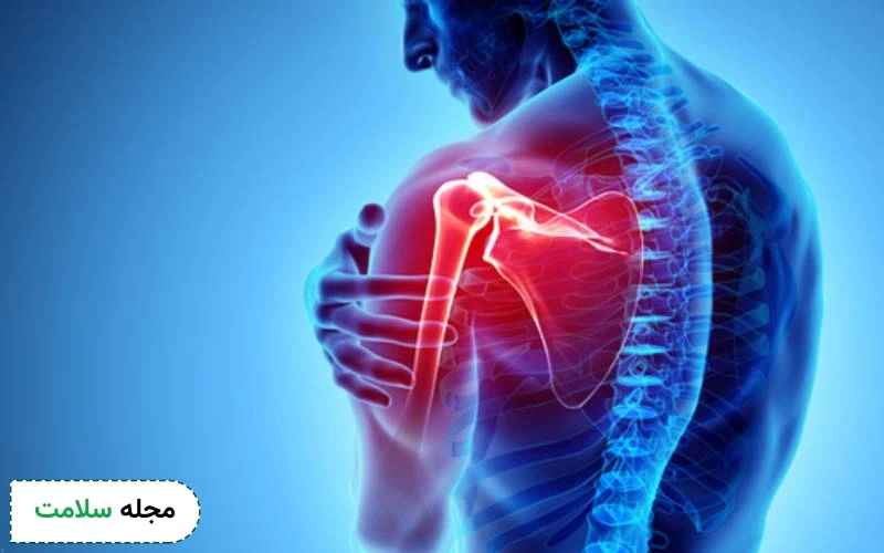 شکستگی کتف چگونه است؟ علائم، راه تشخیص و درمان شکستگی شانه