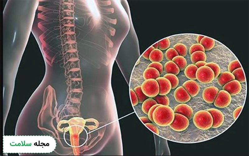 باکتری‌های مقاربتی باعث عفونت واژن شده و این عفونت می‌تواند در کل اندام‌های تناسلی پخش شود. 