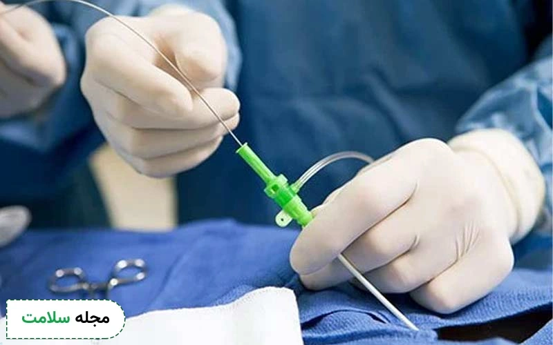 اگر دچار بیماری آریتمی قلبی باشید، پزشک برای درمان ریتم نامنظم قلب ابلیشن قلب را توصیه میکند.