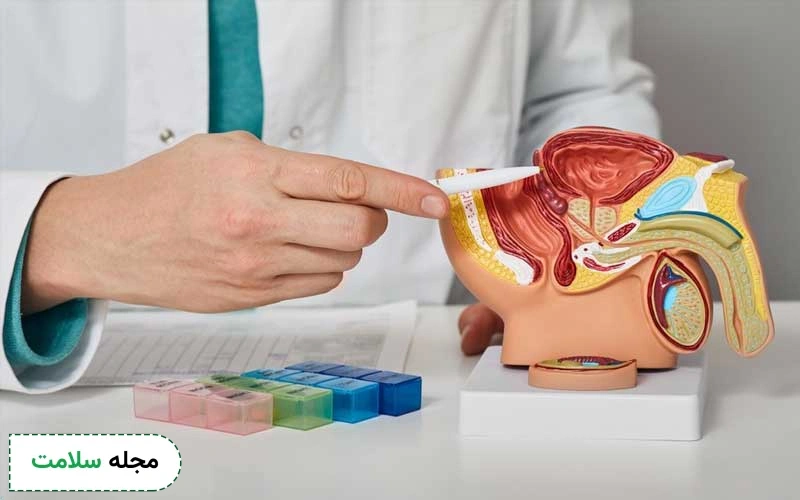 تاکنون متخصصان چهار نوع پروستاتیت را شناسایی کردهاند.