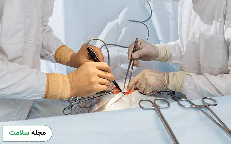 عکس پبوند قلب